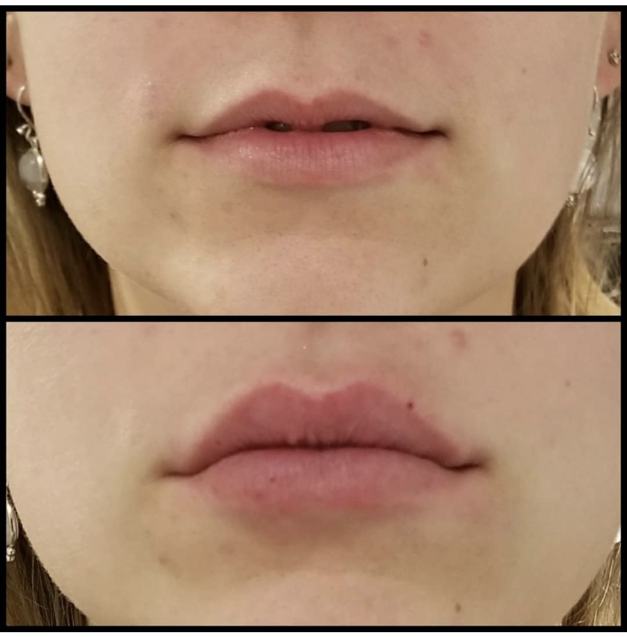 Before and after cosmetic treatment results